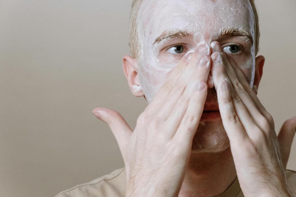 Acne scars